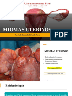 miomas uterinos