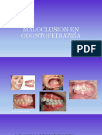 Clase 8 - Maloclusion en Odontopediatría (2)