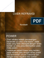 Over Refraksi