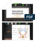 Mullerian Abnormalities