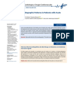 High-Risk Electrocardiographic Patterns in Patients With Acute Coronary Syndrome