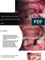 CHIRURGIA PROPROTETICA Stagiu NR 4