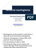 Tentorial Meningiomas