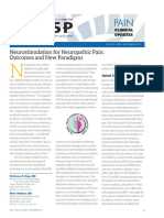 Neurostimulation For Neuropathic Pain: Outcomes and New Paradigms