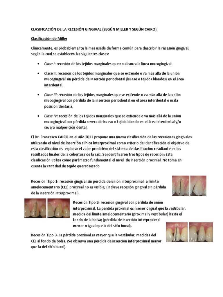 Clasificación de Recesiones Gingivales | PDF | Estudios de idiomas ...