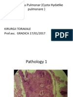 Echinococu Pulmonare JANARE 2015 STUDENTAT