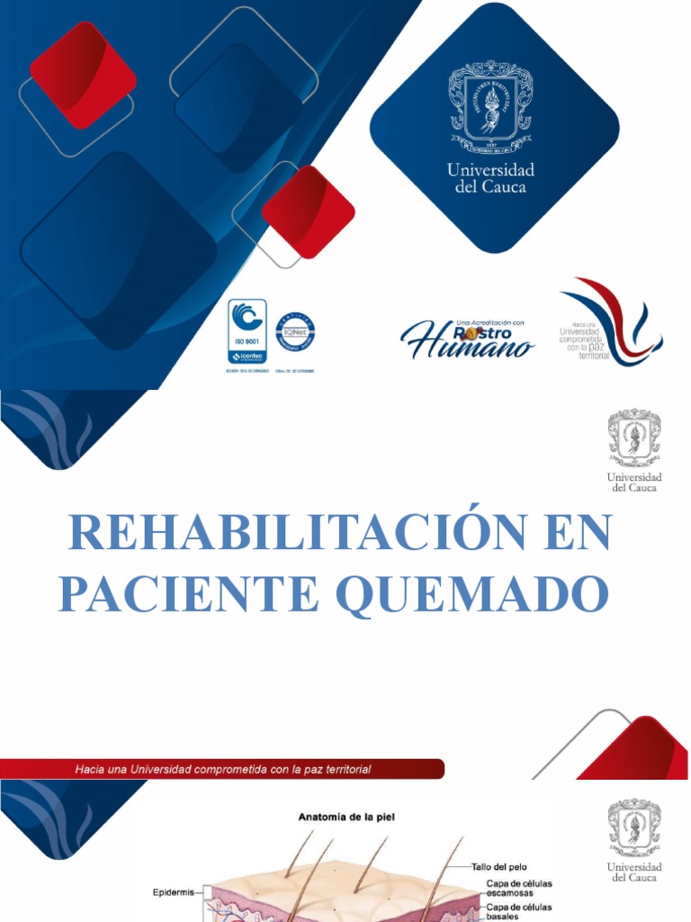 Presentacion Quemados PDF Quemar Herida