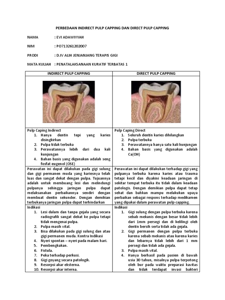 perbedaan-indirect-pulp-capping-dan-direct-pulp-capping-pdf