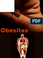 Obesitas (Edhi Rianto, DR., MS.)