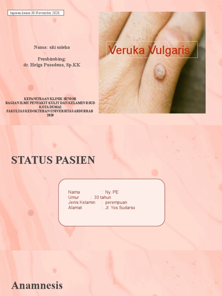 Veruka Vulgaris Kulit 2020 | PDF