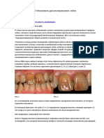 Otbelivanie_depulpirovannykh_zubov