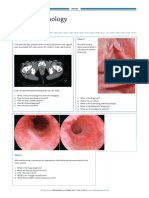 Urethral Pathology: Case 1 Case 2