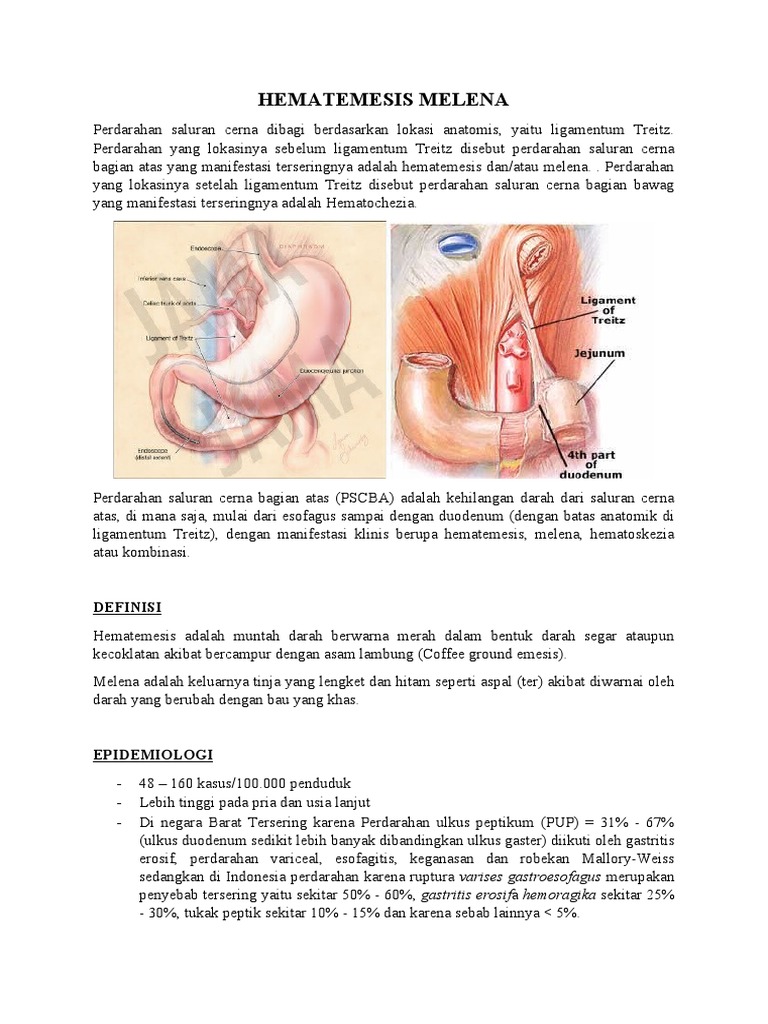 Hematemesis Melena | PDF