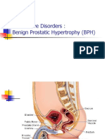 Obstructive Disorders: Benign Prostatic Hypertrophy (BPH)