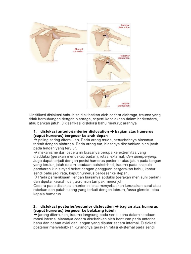 Klasifikasi Dislokasi Bahu: Jenis dan Penyebab | PDF