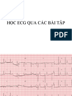 Học ECG qua các bài tập