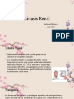 Litiasis Renal