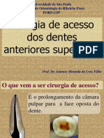 Cirurgia Acesso Anteriores Superiores