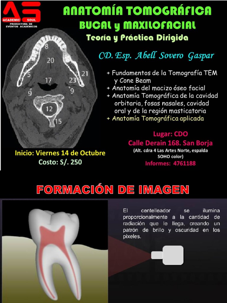 Anatomia Tomografica Bucal y Maxilo Facial (Clase) Part 1 | PDF | Ct ...