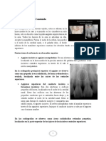 Puntos Anatómicos Importantes Del Maxilar