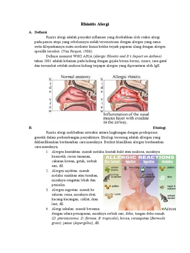 Klasifikasi dan Gejala Rhinitis Alergi | PDF