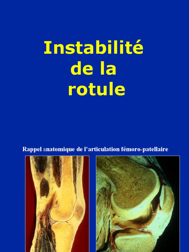 Instabilité et luxation de la rotule | PDF | Genou | Articulation ...