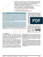 Brain Tumor Detection Using MRI Images