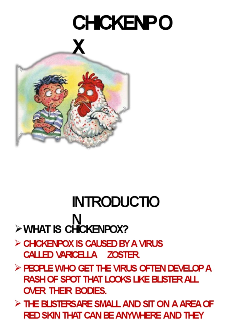 Chicken Pox | PDF | Animal Virology | Animal Viral Diseases