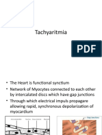 Tachyaritmia