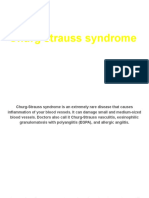 Churg Strauss Syndrome: By, Manchu Ajeesha