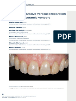 Minimally Invasive