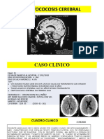 Caso Clinico Malave