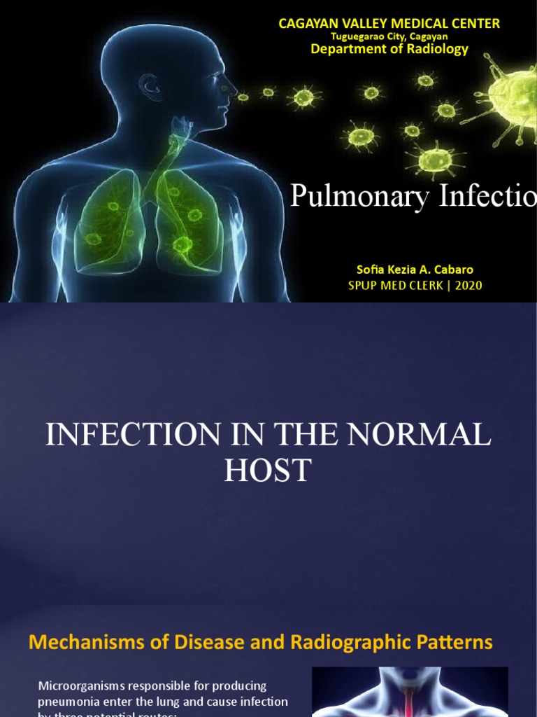 Radiographic Patterns of Pulmonary Infections | PDF | Pneumonia | Lung