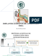 Implantes de Conduccion Osea para Om