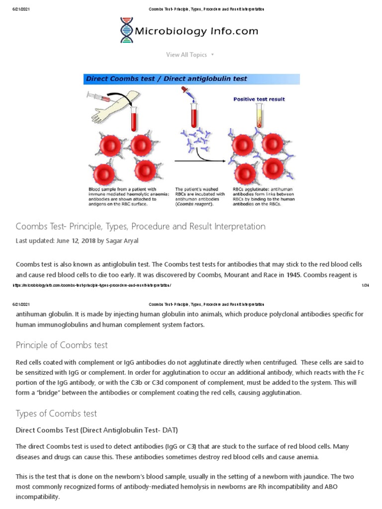 Coombs Test Principle, Types, Procedure and Result Interpretation