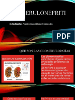 Glomerulonefritis Anatomia Clinca
