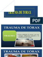 TRUMA DE TORAX