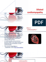 Dilated Cardiomyopathy