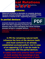 Establishing Functional Occlusion in Removable Partial Dentures