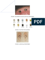 Figure 1:magnents in Maxillofacial Prosthesis