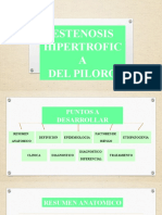 Cirugia pediatrica - Estenosis hipertrofica del piloro