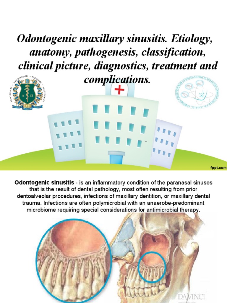 Odontogenic Maxillary Sinusitis. Etiology, Anatomy, Pathogenesis