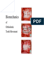 Biomechanics: of Orthodontic Tooth Movement