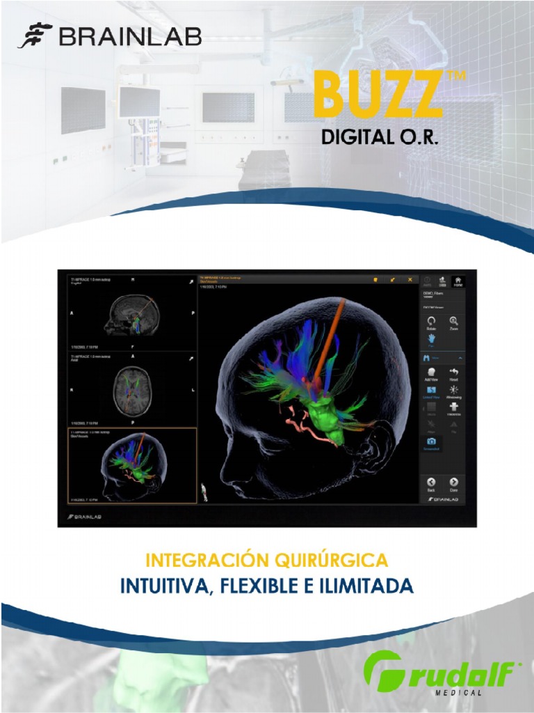 Sistema de Integración Quirúrgica Buzz | PDF | Vídeo | Streaming Media
