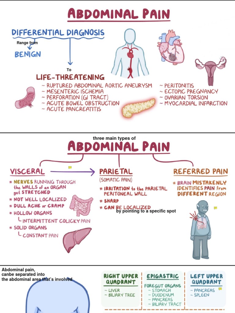 Abdominal Pain Differential Diagnosis Guide | PDF