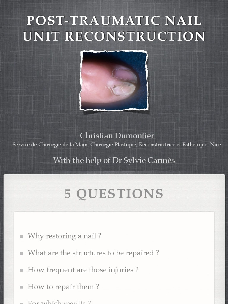 2 Nail Reconstruction PDF Nail (Anatomy) Medical Specialties
