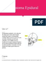 Hematoma Epidural