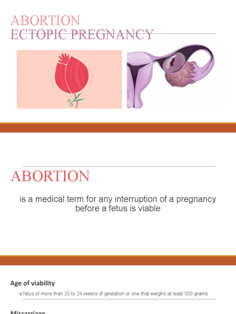 Ectopic Pregnancy | PDF | Miscarriage | Pregnancy