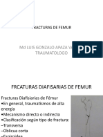 Fractura de Femur
