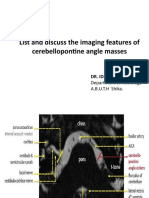 List and Discuss The Imaging Features of Cerebellopontine Angle Masses